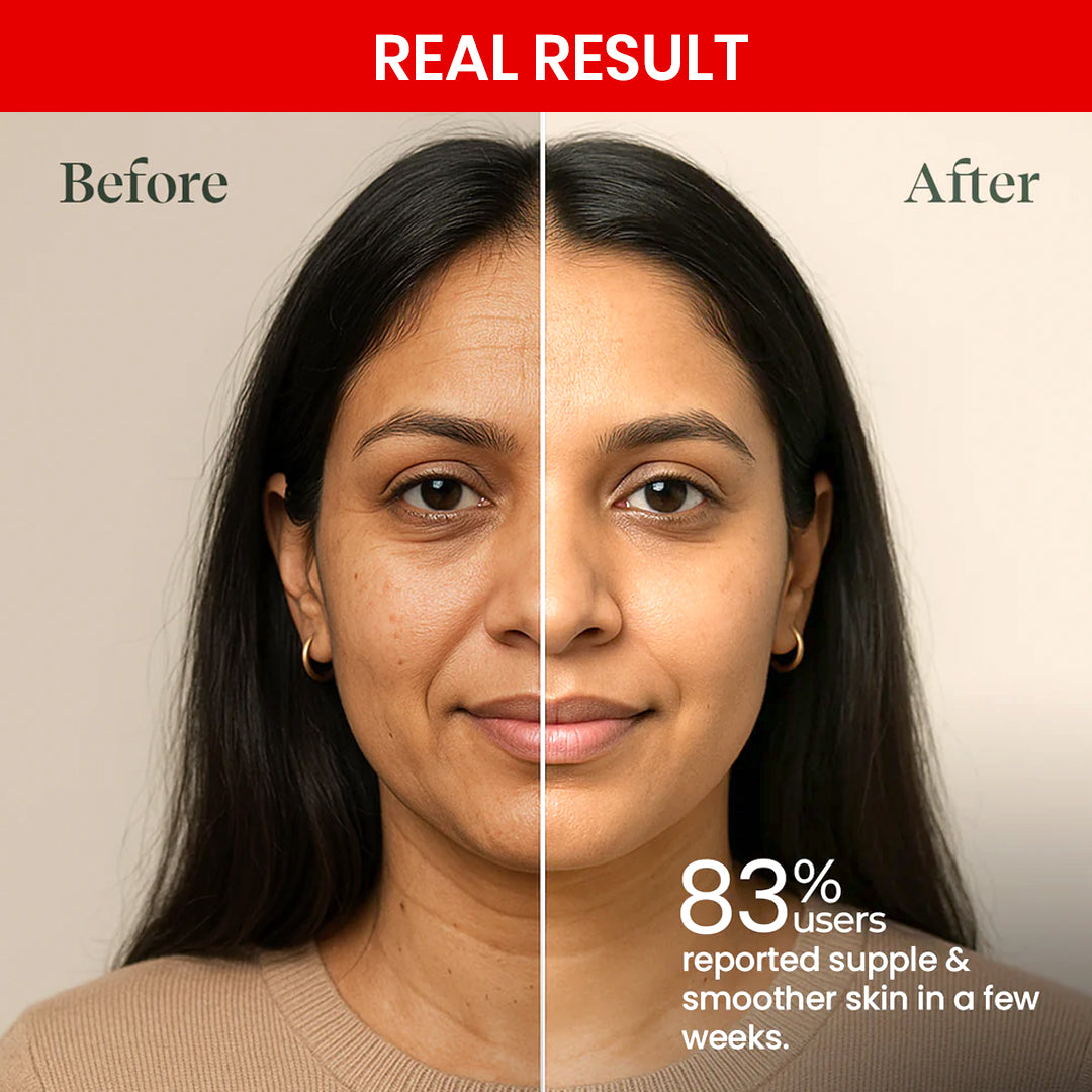 Retinol Pro Night Cream 0.05% (30g)