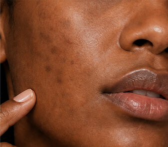 After using the product