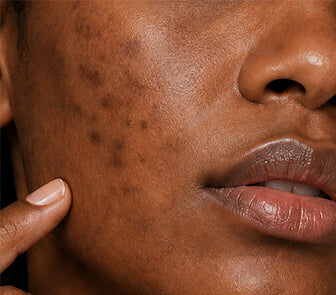 Before using the product