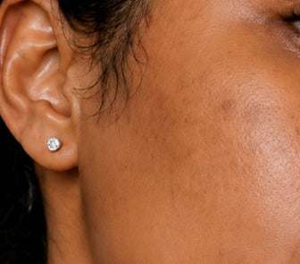 After using the product