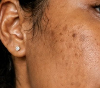 Before using the product