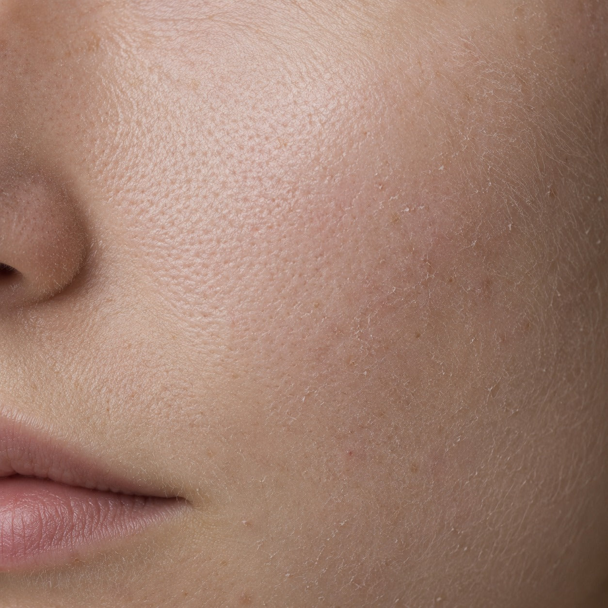 Dry & Dull Skin Solutions