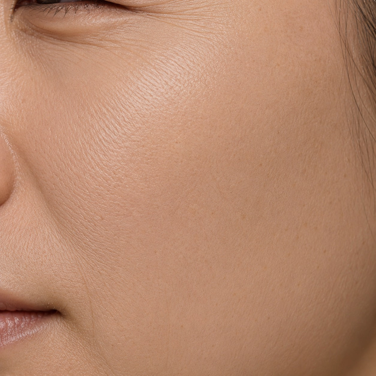 Fine Lines & Wrinkles