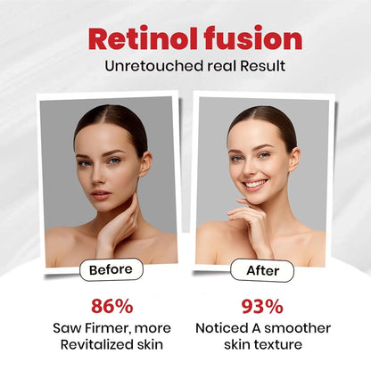 Retinol Fusion Cream 0.05% Transforms Your Nighttime Skincare Routine ( 40g )
